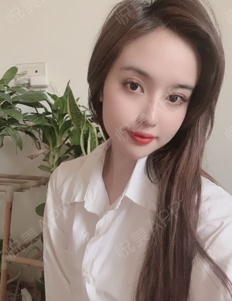 为什么很多人选择玩雷银奥义世界的私服版本？  第2张